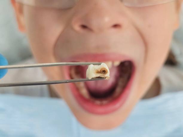 Best Emergency Treatment for Jaw Pain or Injury in Kalispell, MT